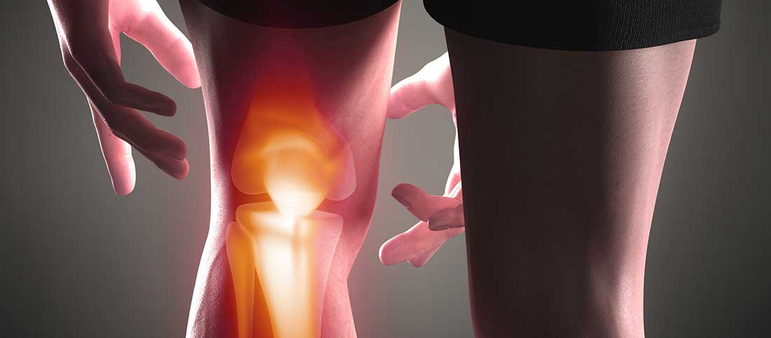 ACLanterior Cruciate Ligament Injury - Mayfair Wellness Clinic Gulshan