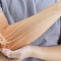 Cubital Tunnel Syndrome - Mayfair Wellness Clinic Gulshan