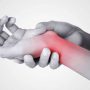 De Quervains Tenosynovitis - Mayfair Wellness Clinic Gulshan