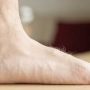 Flat Foot Tratment - Mayfair Wellness Clinic Gulshan