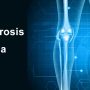 Pseudarthrosis Of Tibia - Mayfair Wellness Clinic Gulshan