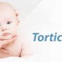 Torticollis - Mayfair Wellness Clinic Gulshan