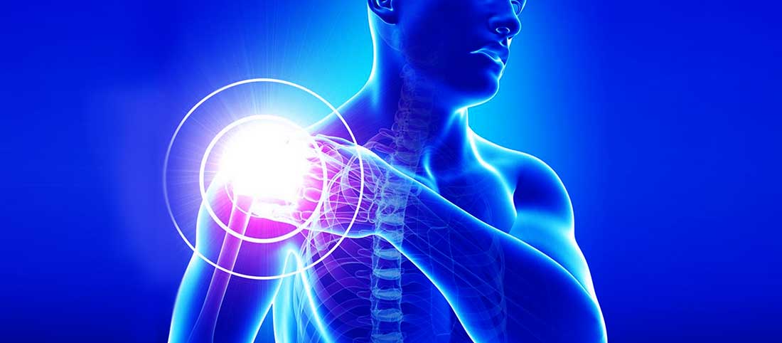Bicespstendinopath Mayfairy - Mayfair Wellness Clinic Gulshan