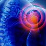 Slap Joint - Mayfair Wellness Clinic Gulshan