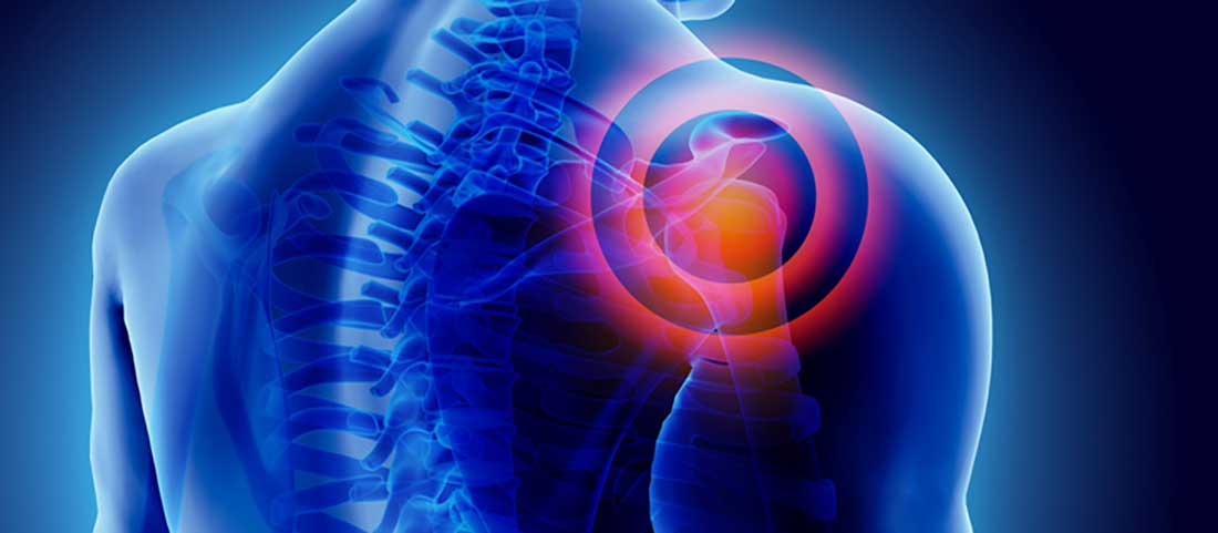Slap Joint - Mayfair Wellness Clinic Gulshan