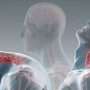 Whiplash Injury - Mayfair Wellness Clinic Gulshan