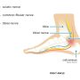 Tarsal Tunnel Syndrome - Mayfair Wellness Clinic Gulshan