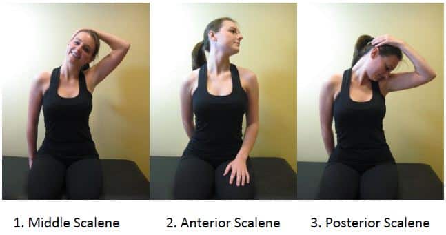 Thoracic Outlet Syndrome2 Thoracic Outlet Syndrome