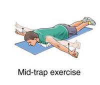 Thoracic Outlet Syndrome6 Thoracic Outlet Syndrome