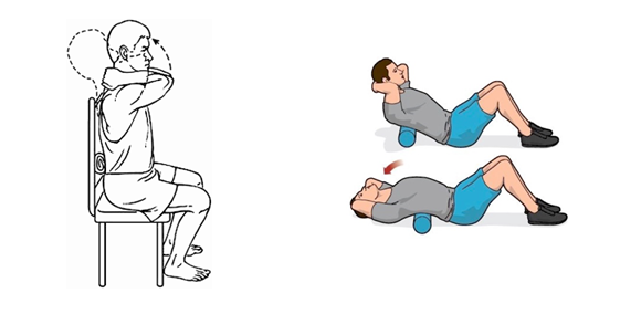 Thoracic Outlet Syndrome7 Thoracic Outlet Syndrome