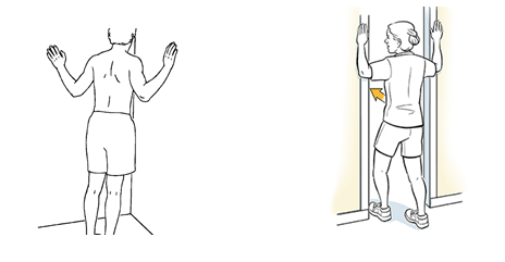 Thoracic Outlet Syndrome8 Thoracic Outlet Syndrome