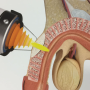 Hormones Peyronies Disease Erect - Mayfair Wellness Clinic Gulshan