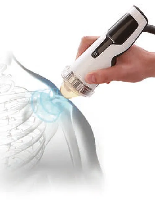A Man Taking Focused Shockwave Therapy - Mayfair Wellness Clinic Gulshan